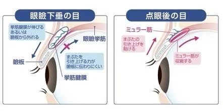 点眼後の仕組み